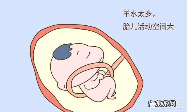 胎儿出现脐带绕颈，跟孕妇睡觉姿势有关吗？