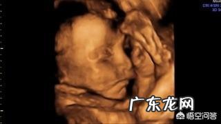 胎儿出现脐带绕颈,跟孕妇睡觉姿势有关吗?