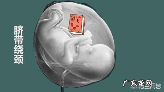 胎儿出现脐带绕颈,跟孕妇睡觉姿势有关吗?