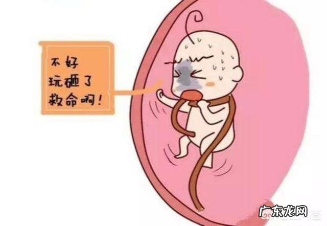 胎儿出现脐带绕颈，跟孕妇睡觉姿势有关吗？