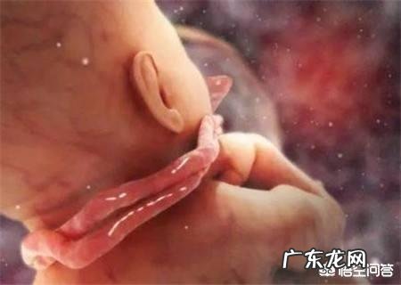 胎儿出现脐带绕颈,跟孕妇睡觉姿势有关吗?