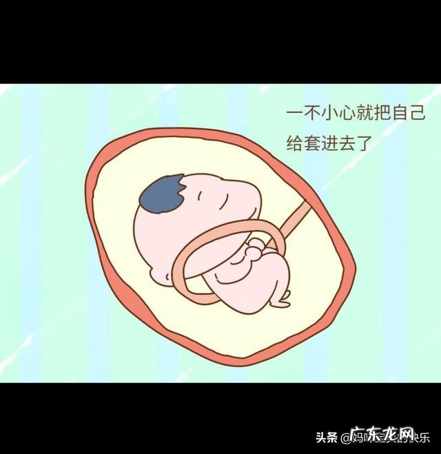 胎儿出现脐带绕颈,跟孕妇睡觉姿势有关吗?