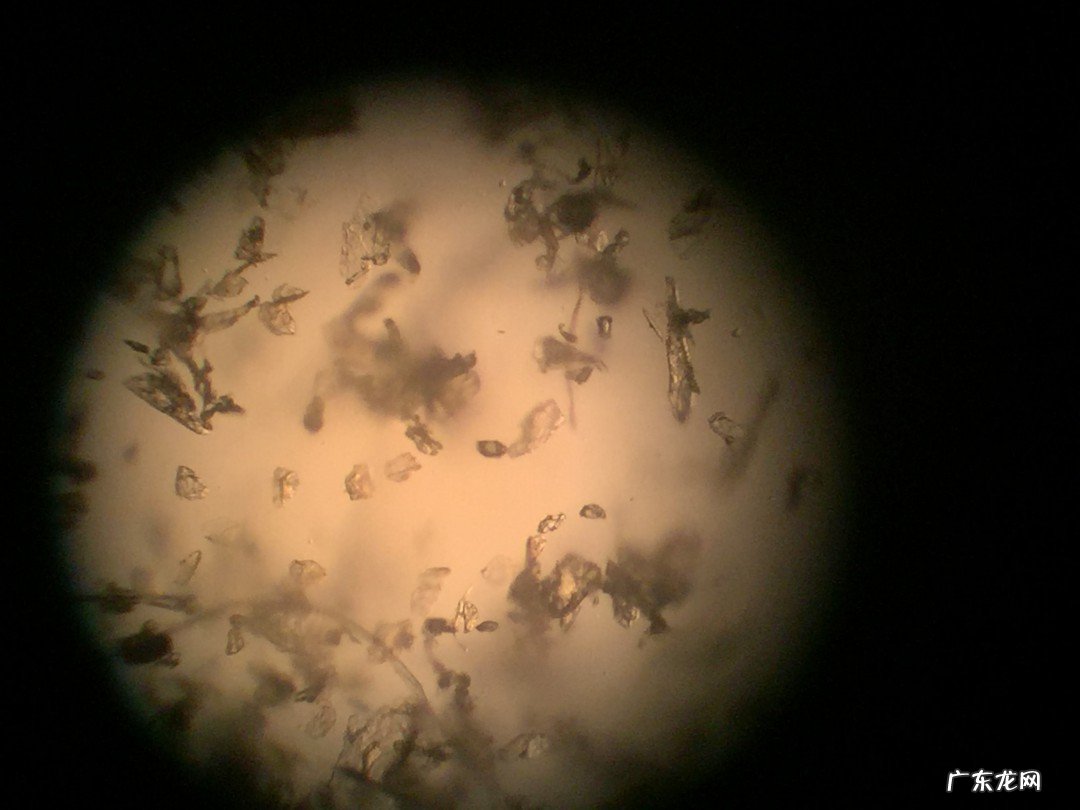 户尘螨是什么东西