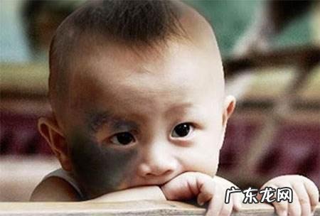 胎记的形成原因,如何才能消除它?