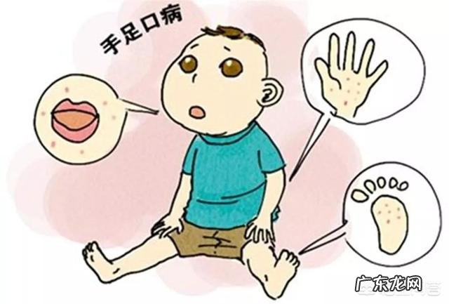 手足口病是一种儿童病吗,大人会不会得这个病?该如何防治呢?