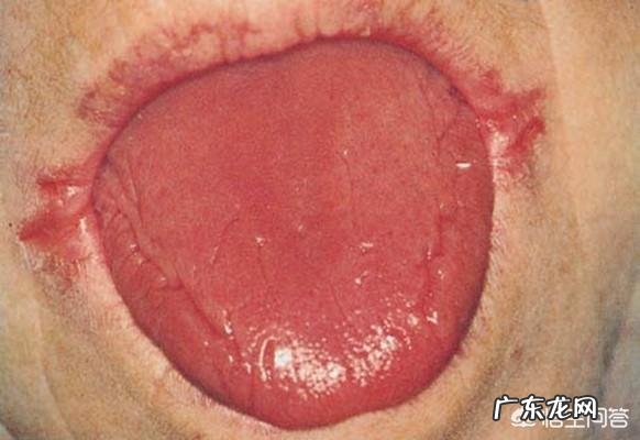 维生素B2有什么作用?