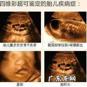 四维可以做两次吗?有没有什么影响?