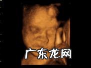 四维可以做两次吗？有没有什么影响？