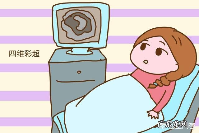 四维可以做两次吗?有没有什么影响?