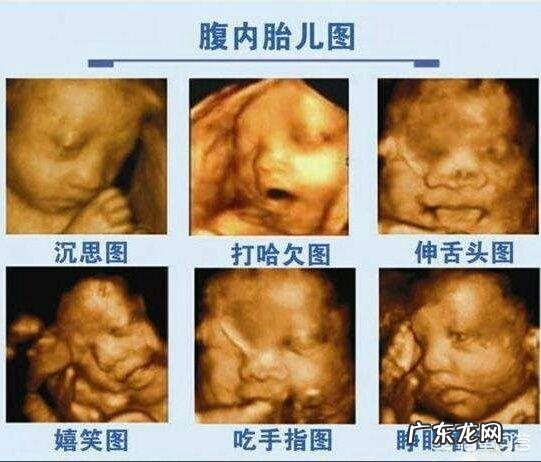 四维可以做两次吗?有没有什么影响?