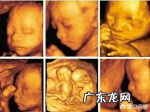 四维可以做两次吗?有没有什么影响?