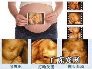 四维可以做两次吗?有没有什么影响?