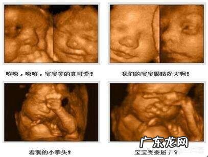 四维可以做两次吗？有没有什么影响？