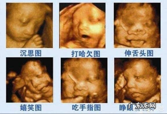 四维可以做两次吗？有没有什么影响？