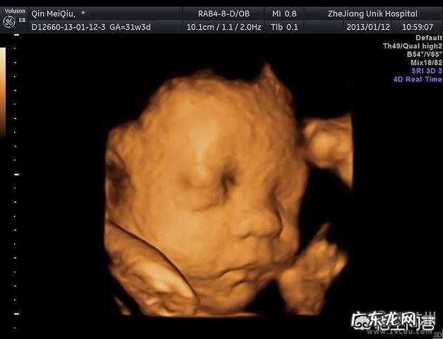 四维可以做两次吗?有没有什么影响?