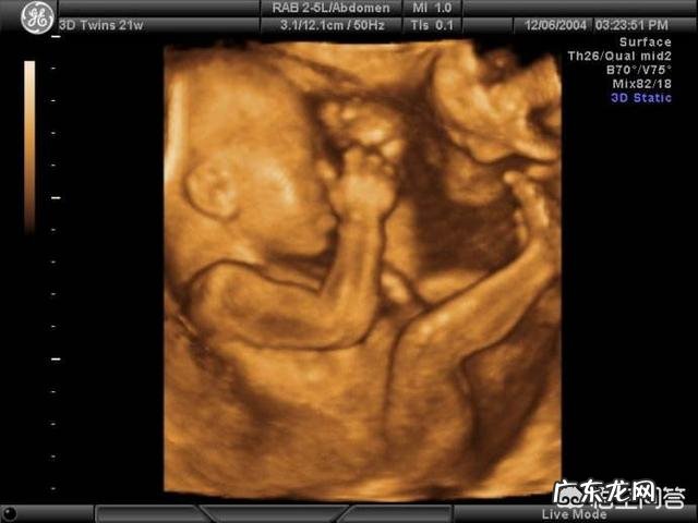 四维可以做两次吗?有没有什么影响?