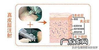 有什么最有效的方法去掉颈纹?
