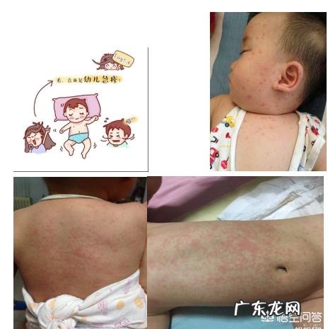 小孩没有感冒症状,怎么就发高烧了?