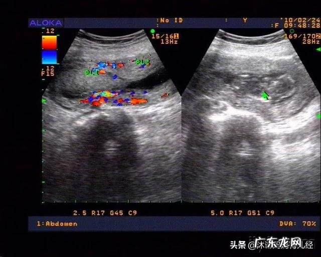 停胎有什么症状?停胎多久能发现?