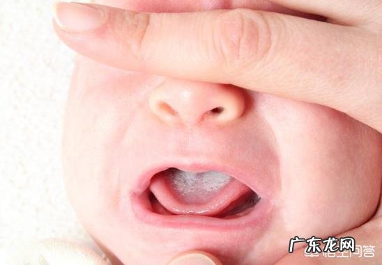 哪些因素导致小儿鹅口疮?