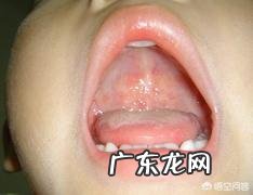 哪些因素导致小儿鹅口疮?