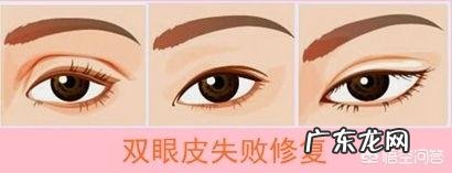 双眼皮能修复几次?