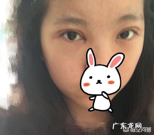 双眼皮能修复几次?