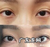 双眼皮能修复几次?