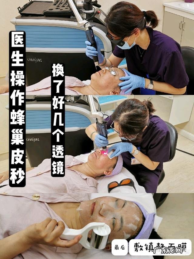 祛除老年斑最有效的方法是什么?