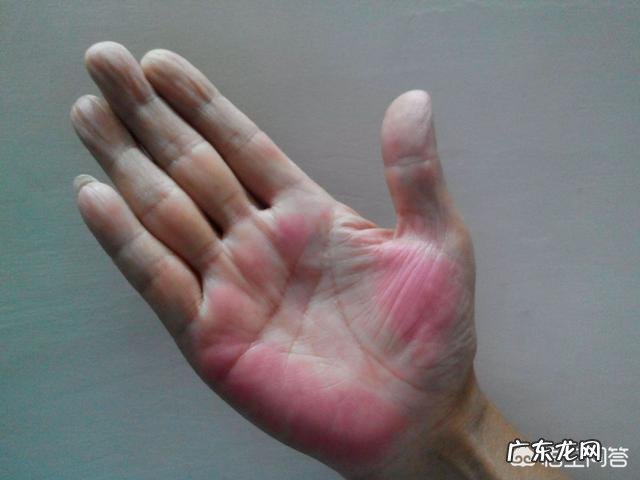 肝不好,有什么异常表现?如何保护肝脏健康?