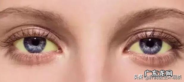 肝不好,有什么异常表现?如何保护肝脏健康?