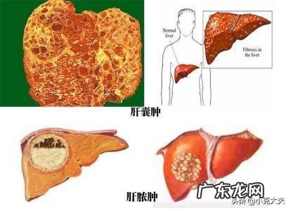 肝不好，有什么异常表现？如何保护肝脏健康？