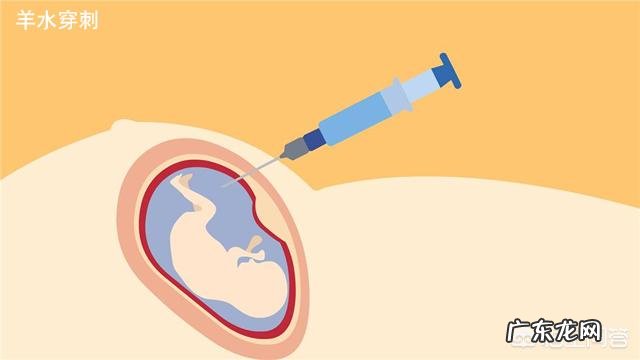 羊穿和脐带血穿刺哪个更准确?