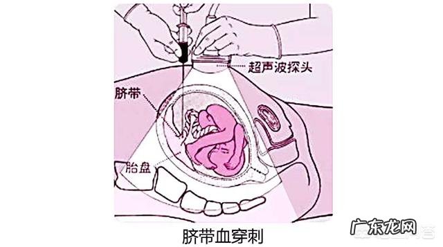 羊穿和脐带血穿刺哪个更准确?