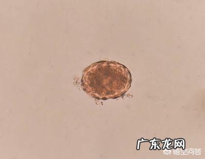 蛔虫病如何治疗？