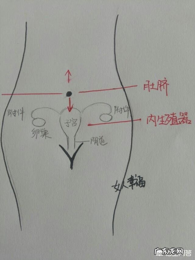 盆腔积液到底是不是病?