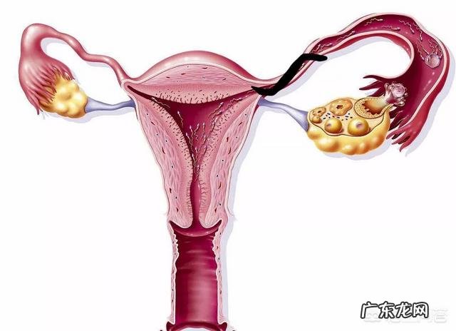 做试管婴儿如何避免宫外孕的发生？