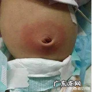 新生儿宝宝的脐部如何进行护理？