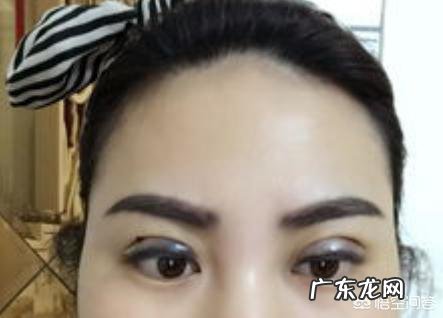 你们觉得埋线双眼皮怎么样?