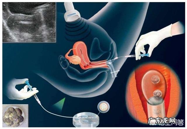 美国试管婴儿如何提高胚胎着床率?
