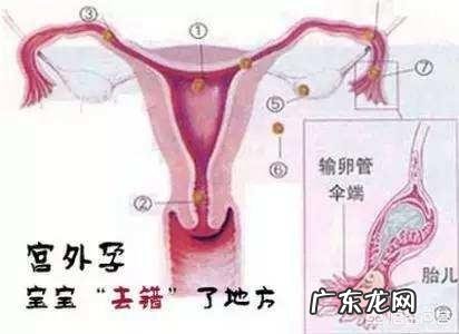 孕早期阴道流血是怎么回事?