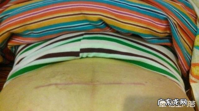 剖腹产坐月子要多长时间?月子期间需要注意哪些事项?