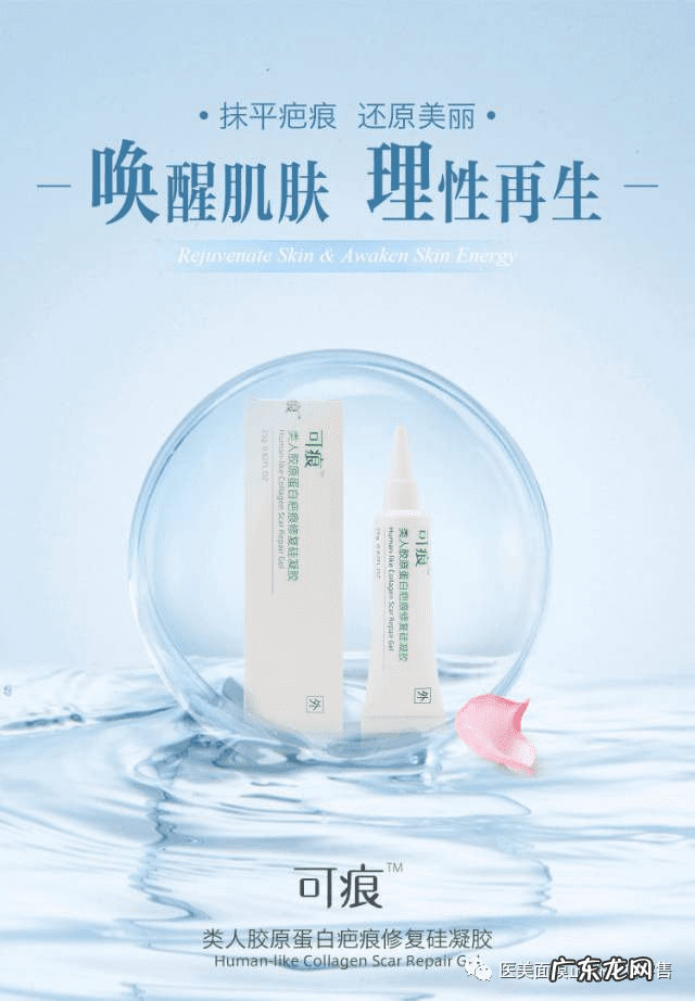 如何治疤痕 怎样治疗疤痕有效