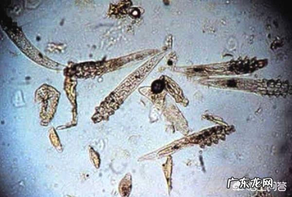 毛孔里挤出来好多硬硬的颗粒物是什么东西?捏碎的时候还油油的?怎么去除啊?