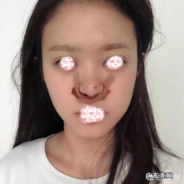 鼻子大，鼻翼宽怎么办？