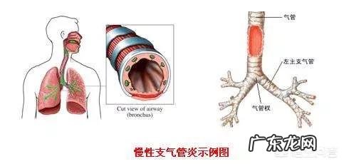 慢性支气管炎和哮喘有什么不同?