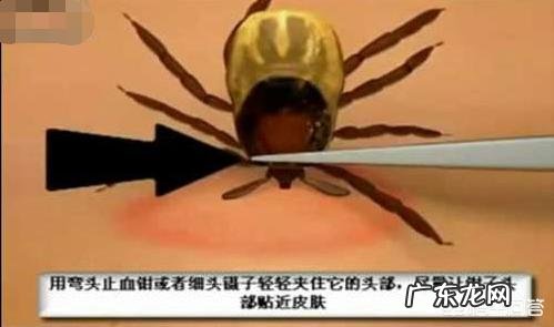 为什么狗狗身上会长蜱虫?该怎么去掉?