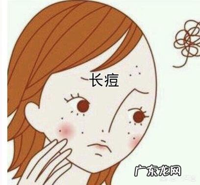 额头上不断长痘痘,还反反复复不消是怎么回事?需要怎样做才能很好的缓解呢?