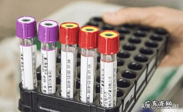 一招判断艾滋病小红点 艾滋检测结果怎么看