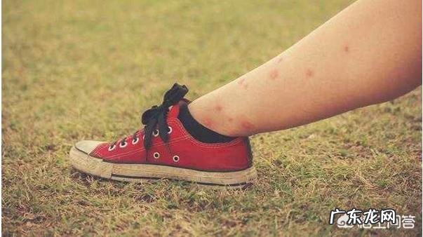 为什么蚊子总叮我?不管多少人,就叮我一个。血型的原因吗?